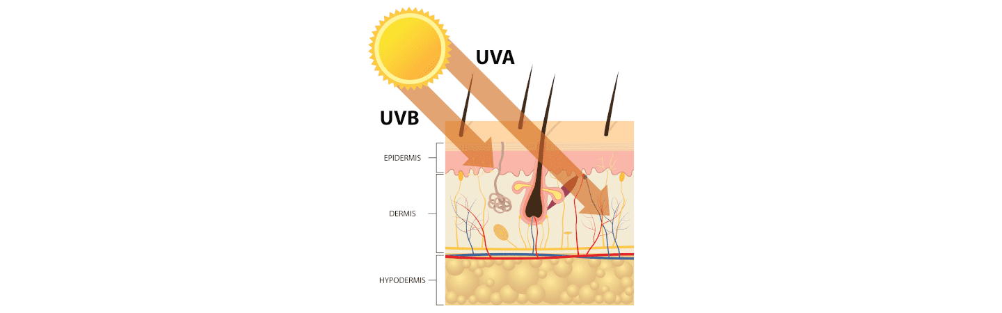 Auswirkungen von UVA- und UVB-Strahlen auf die Haut