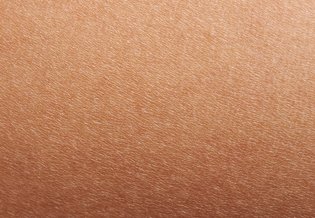 Larocheposay-ArticlePage-Eczema-Dry-skin-vs-eczema