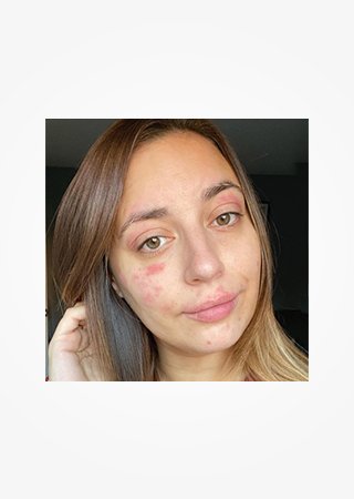 https://www.laroche-posay.ch/-/media/project/loreal/brand-sites/lrp/emea/ch/simple-page/landing-page/brand-campaign/flip_card/flip_card-03.jpg