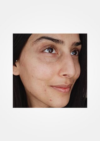 https://www.laroche-posay.ch/-/media/project/loreal/brand-sites/lrp/emea/ch/simple-page/landing-page/brand-campaign/flip_card/flip_card-04.jpg