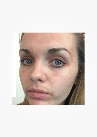 https://www.laroche-posay.ch/-/media/project/loreal/brand-sites/lrp/emea/ch/simple-page/landing-page/brand-campaign/flip_card/flip_card-05.jpg