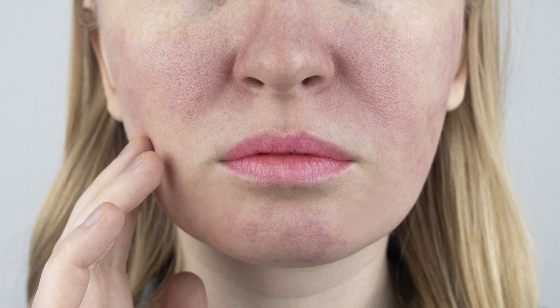 Nachaufnahme eines Gesichts einer Frau mit großen Poren