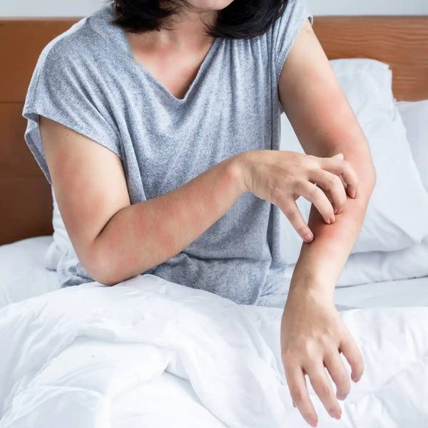 Milbenallergie: Allergische Hautreaktion im Bett