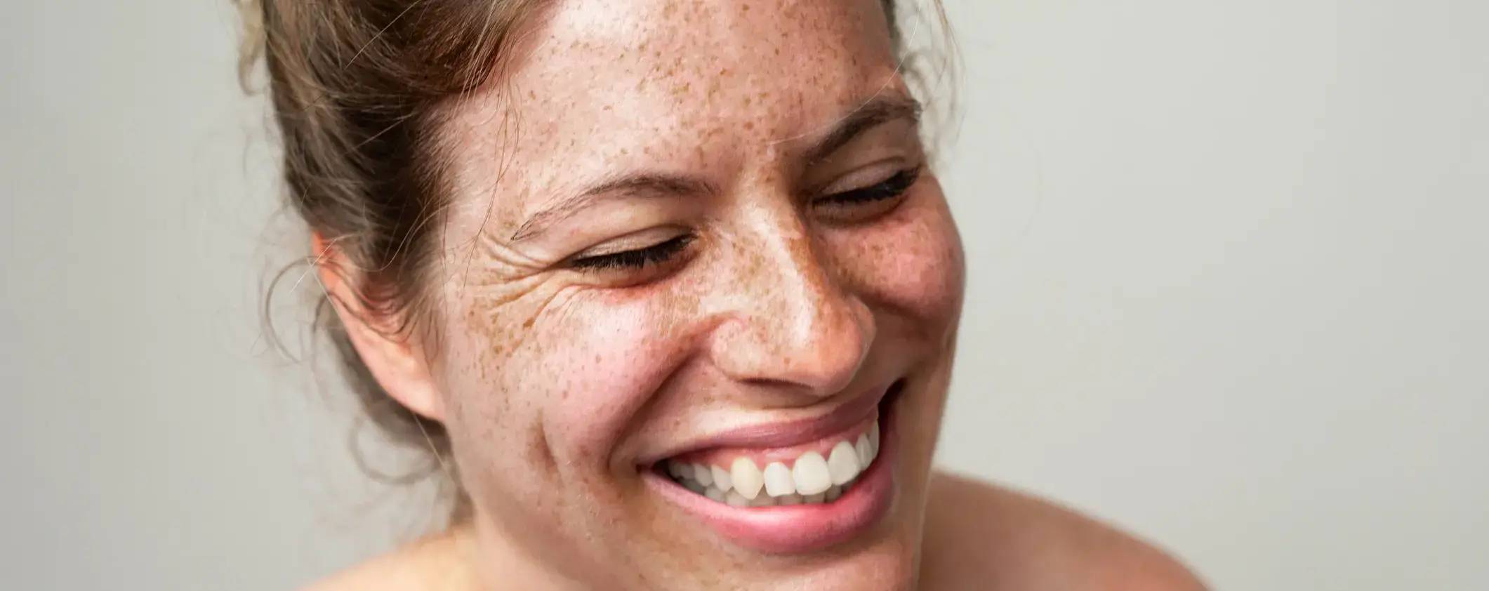 Lachende Frau mit Sommersprossen im Gesicht