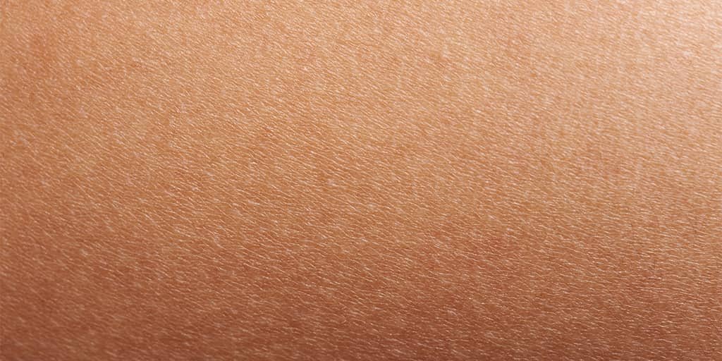 Neurodermitis oder trockene Haut: Bild von einer trockenen Haut im Zoom