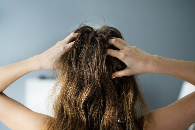 Frau juckt sich die Kopfhaut