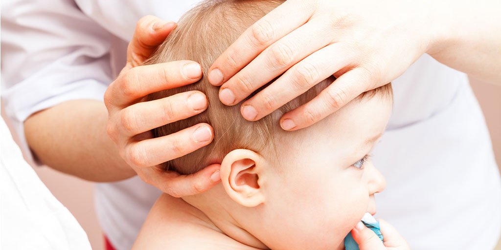 Larocheposay ArticlePage Eczema Seborrheic dermatitis
