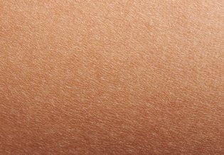 Larocheposay-ArticlePage-Eczema-Dry-skin-vs-eczema