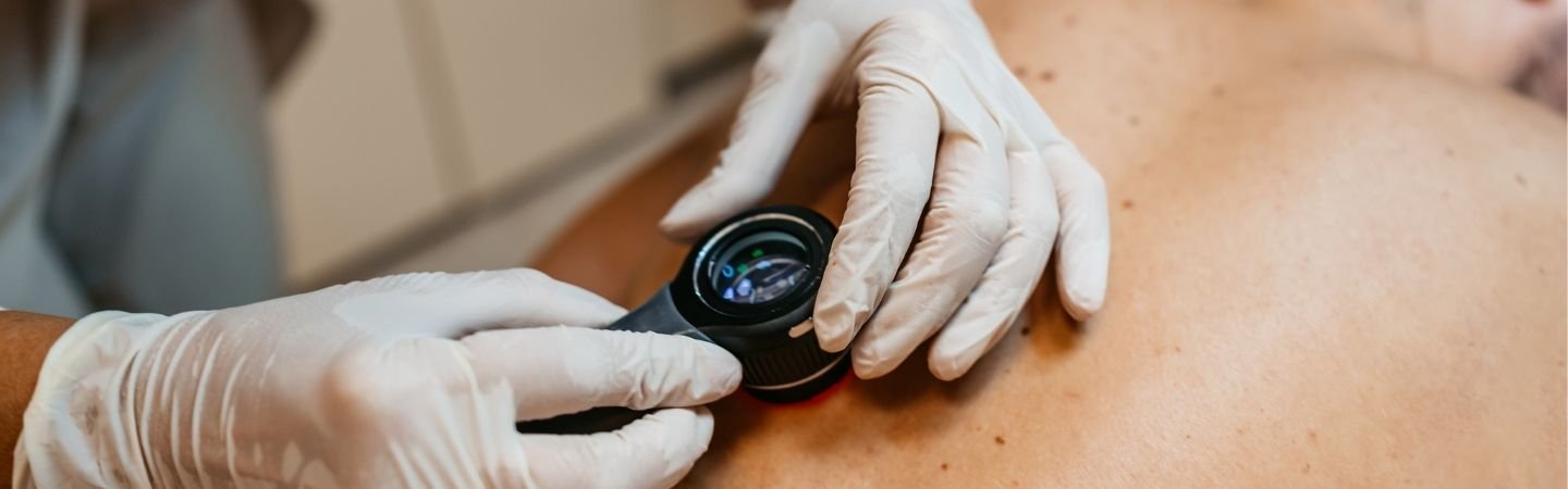 Ärztin untersucht dunkle Flecken auf dem Rücken eines Patienten