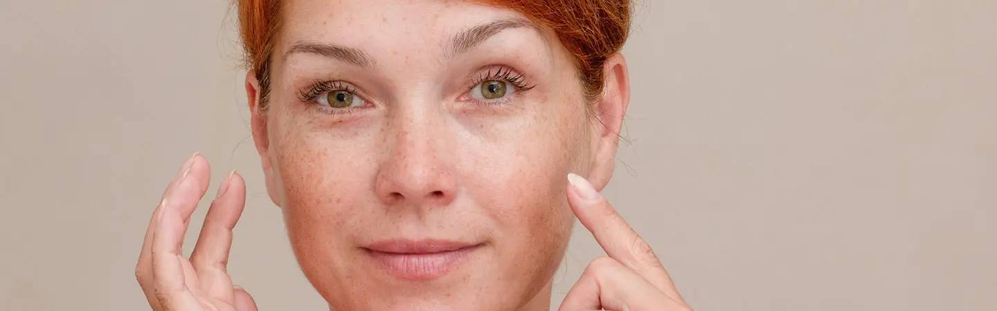 Junge Frau mit roten Haaren und mit leichten Pigmentflecken im Gesicht