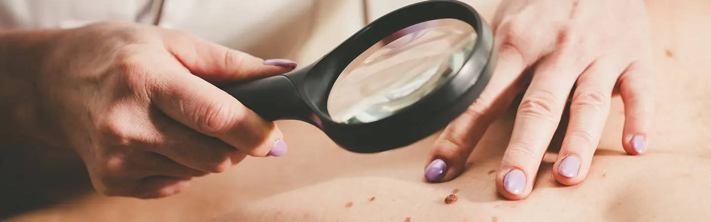 Un dermatologue examine un grain de beauté sur le dos d’un patient