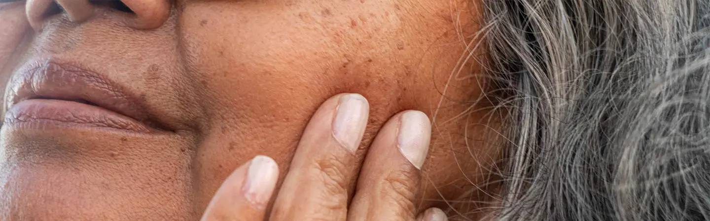 Femme âgée avec des grains de beauté sur le visage