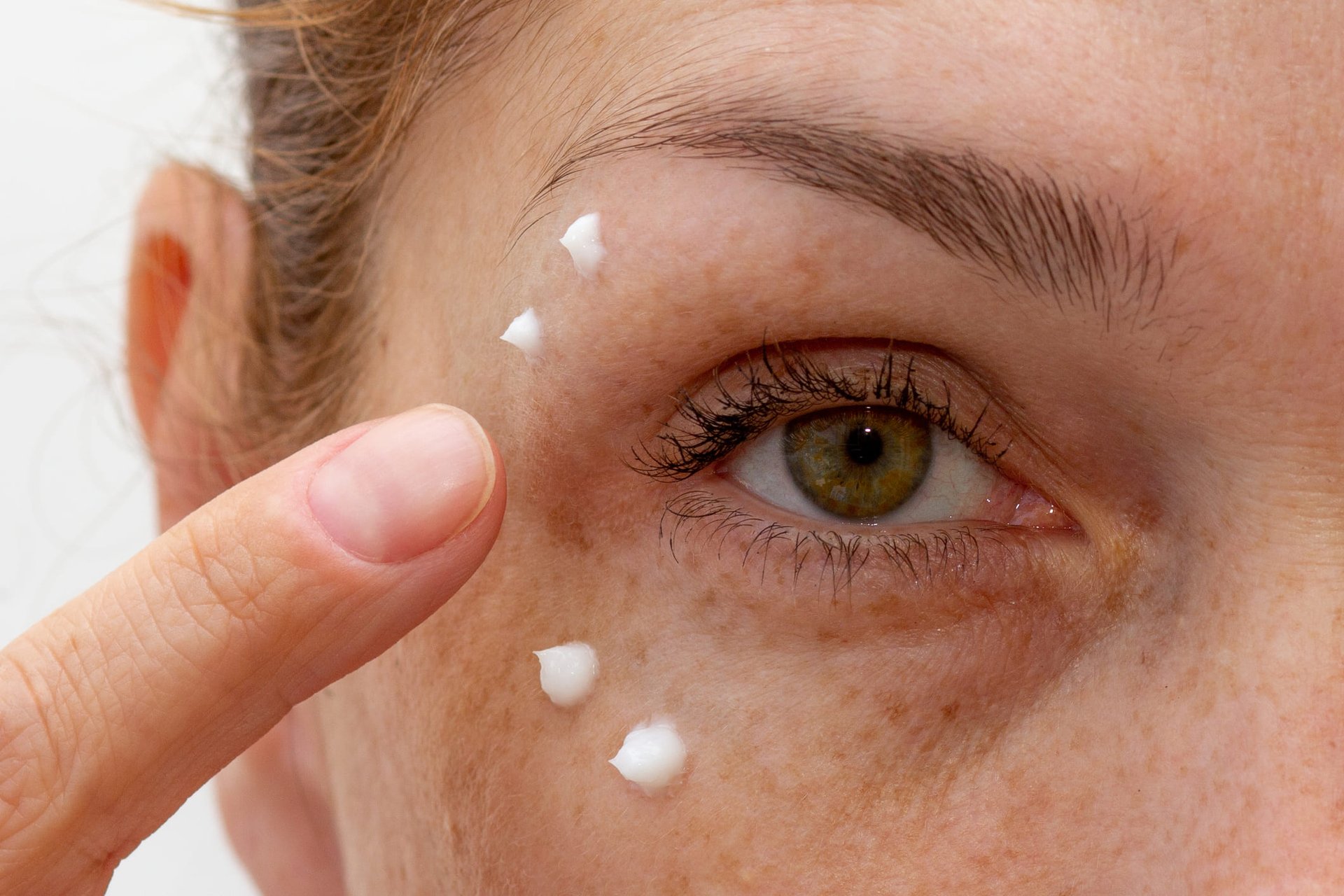 Nahaufnahme von einem Auge mit vier Creme-Punkten