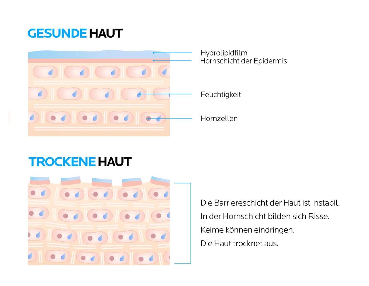 Unterschied gesunde und trockene Haut