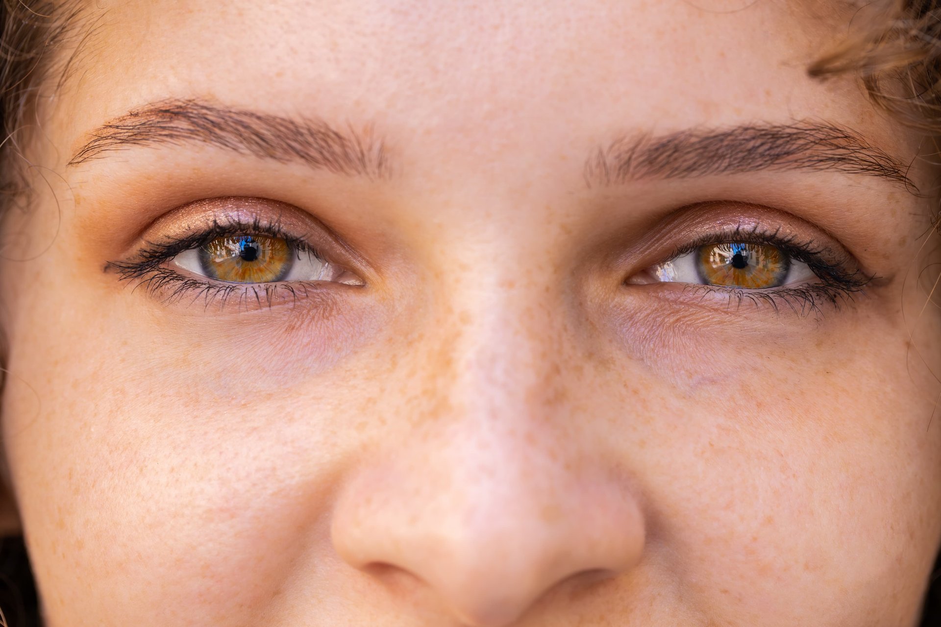 Augenpartie und Nase einer Frau mit Pigmentflecken und braun-grauen Augen
