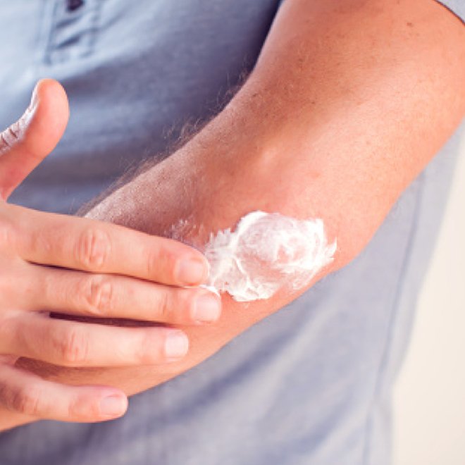 Eine Person trägt Creme auf ihren Ellenbogen auf, um trockene Haut zu behandeln.