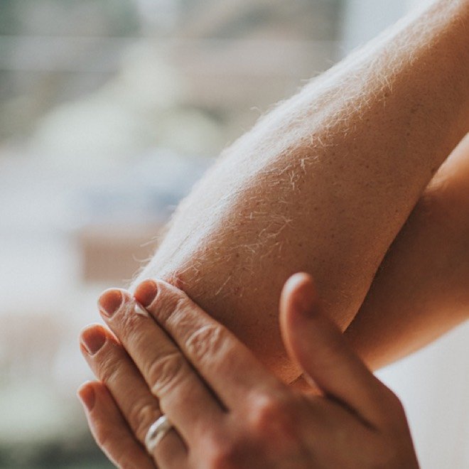Eine Nahaufnahme einer Person, die mit der Hand über die trockene Haut ihres Unterarms streicht.