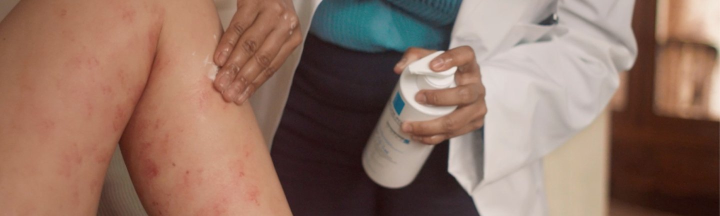 Un médecin applique une crème sur la peau irritée de la jambe d'un patient.